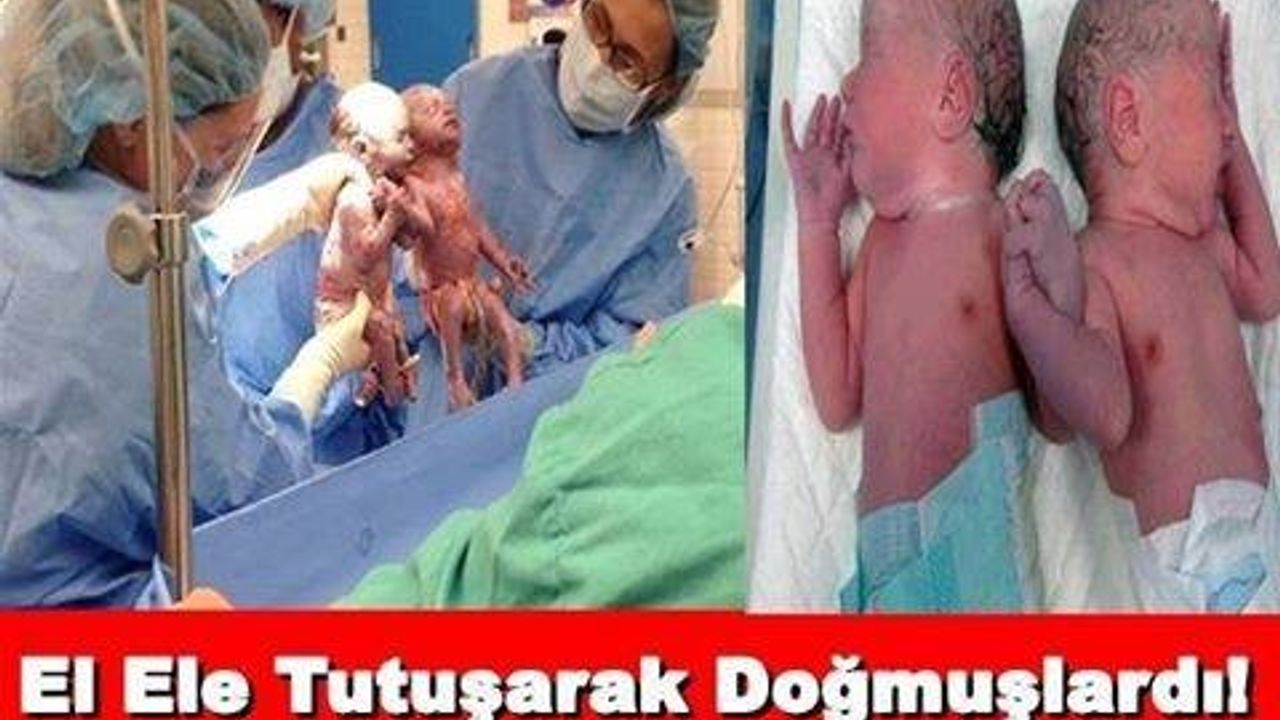 El Ele Tutuşarak Doğmuşlardı! Bakın Şimdi Ne Haldeler!
