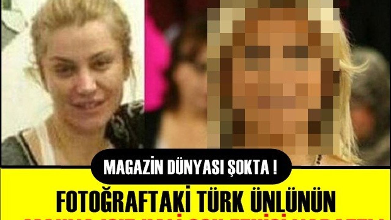 HİÇ HATIRLADIĞINIZ GİBİ DEĞİL! BAKIN NE HALDE...TÜRK MAGAZİN DÜNYASI ŞOKTA !