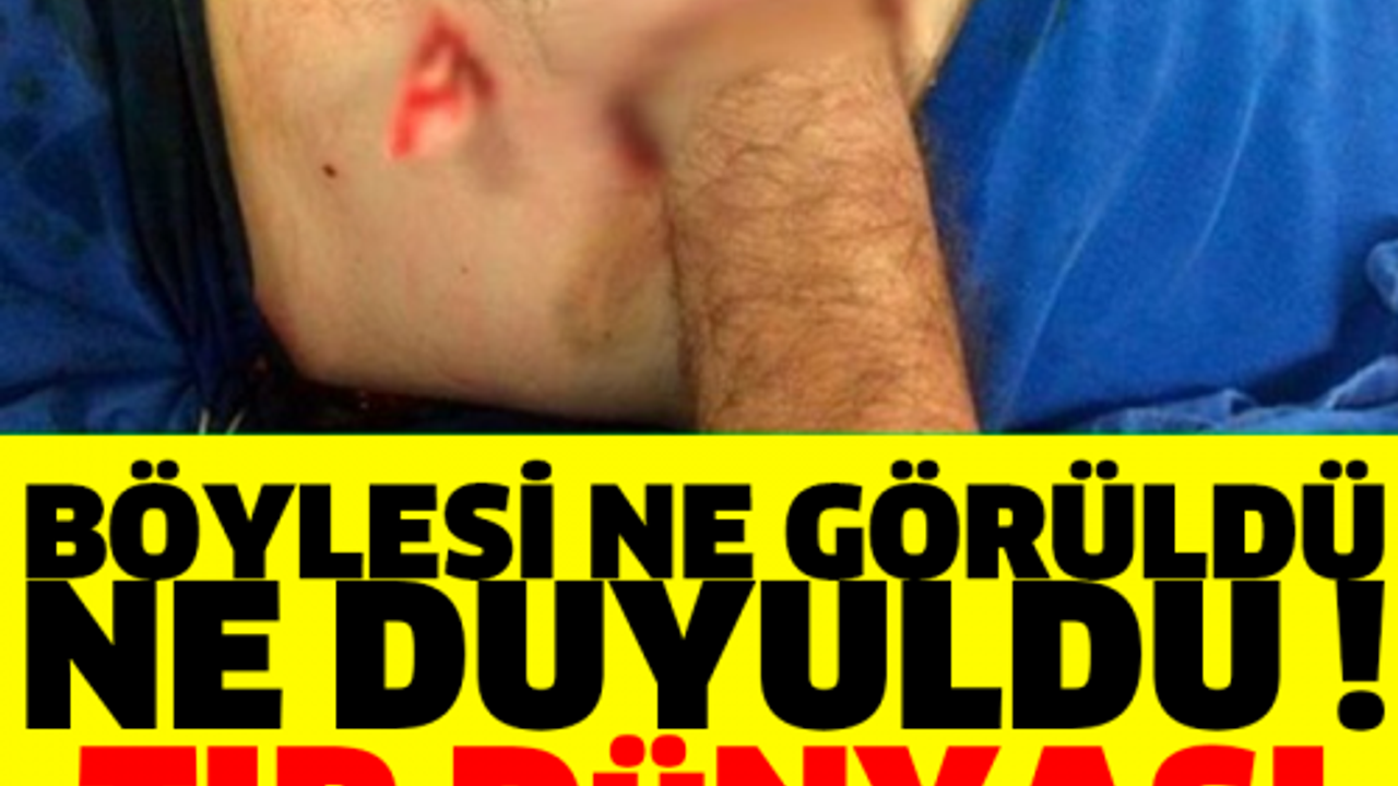 BÖYLESİ NE GÖRÜLDÜ NE DUYULDU ! TIP DÜNYASI ŞOKTA!