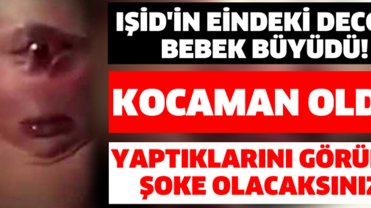 Şimdi Herkes Onu Konuşuyor! Dünyanın Konuştuğu Deccal Bebek Büyüdü!