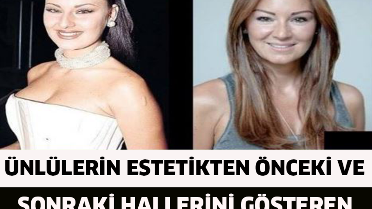 Ünlülerin Estetikten Önceki Ve Sonraki Hallerini Gösteren 14 Çarpıcı Fotoğraf