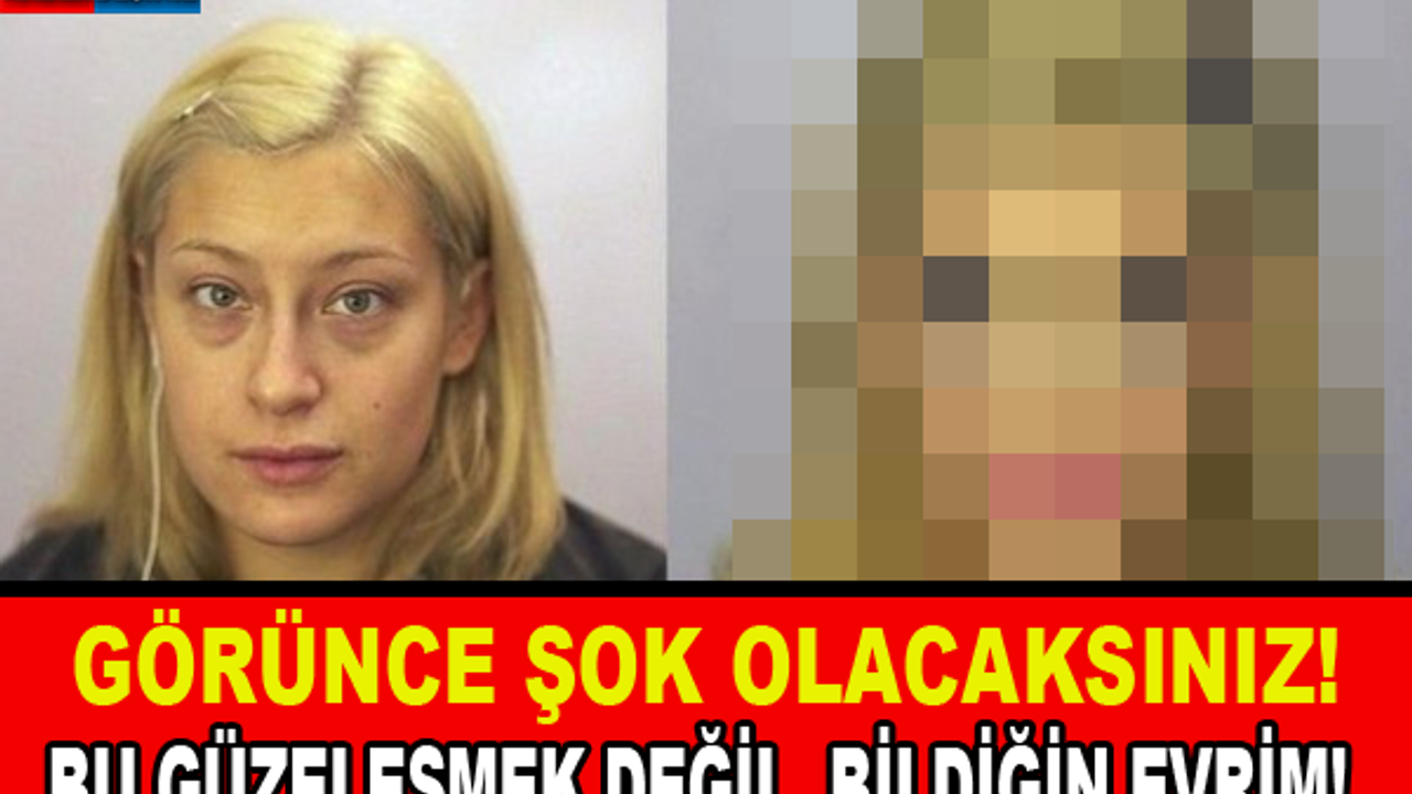 Görünce Şok Olacaksınız! Bu Güzelleşmek Değil, Bildiğin Evrim..