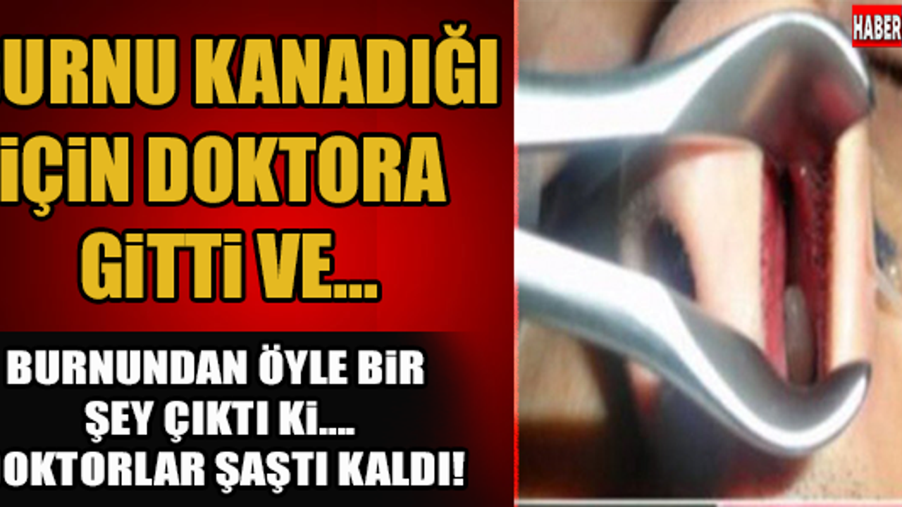 Burnu Kanadığı İçin Doktora Gitti Fakat Sebebini Öğrenince Şoke Oldu!