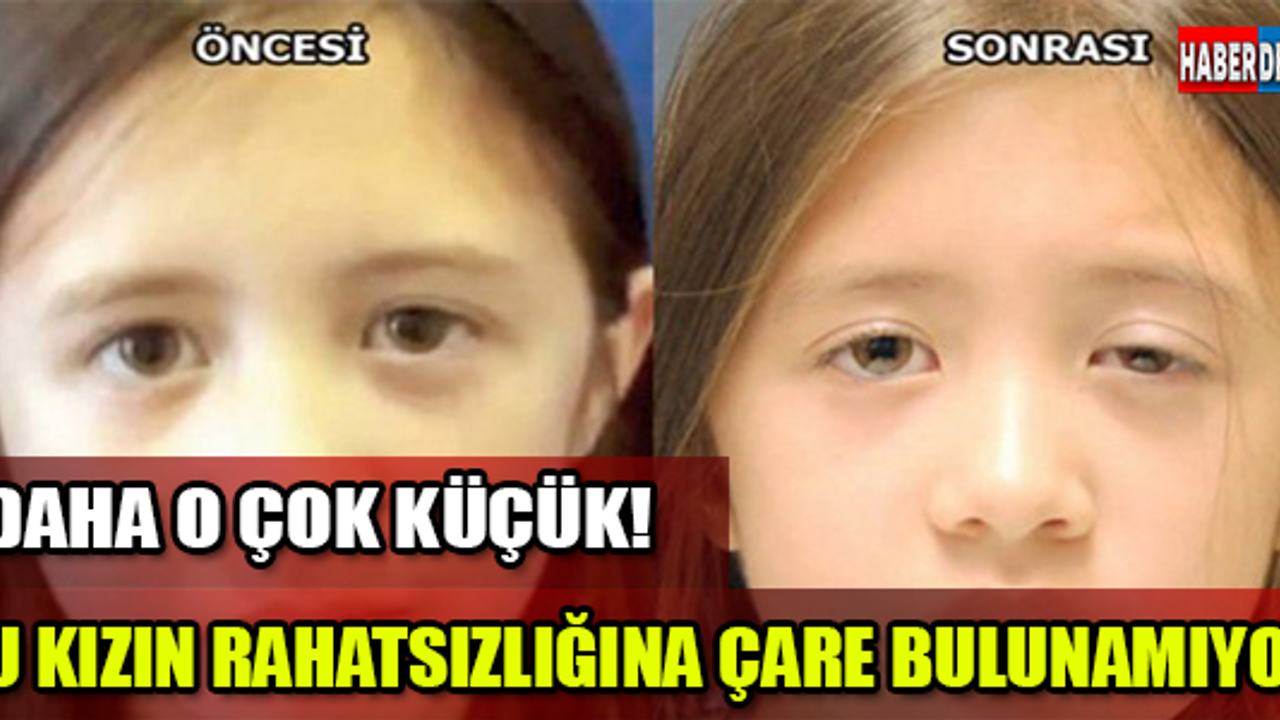 BU KIZIN RAHATSIZLIĞINA ÇARE BULUNAMIYOR!