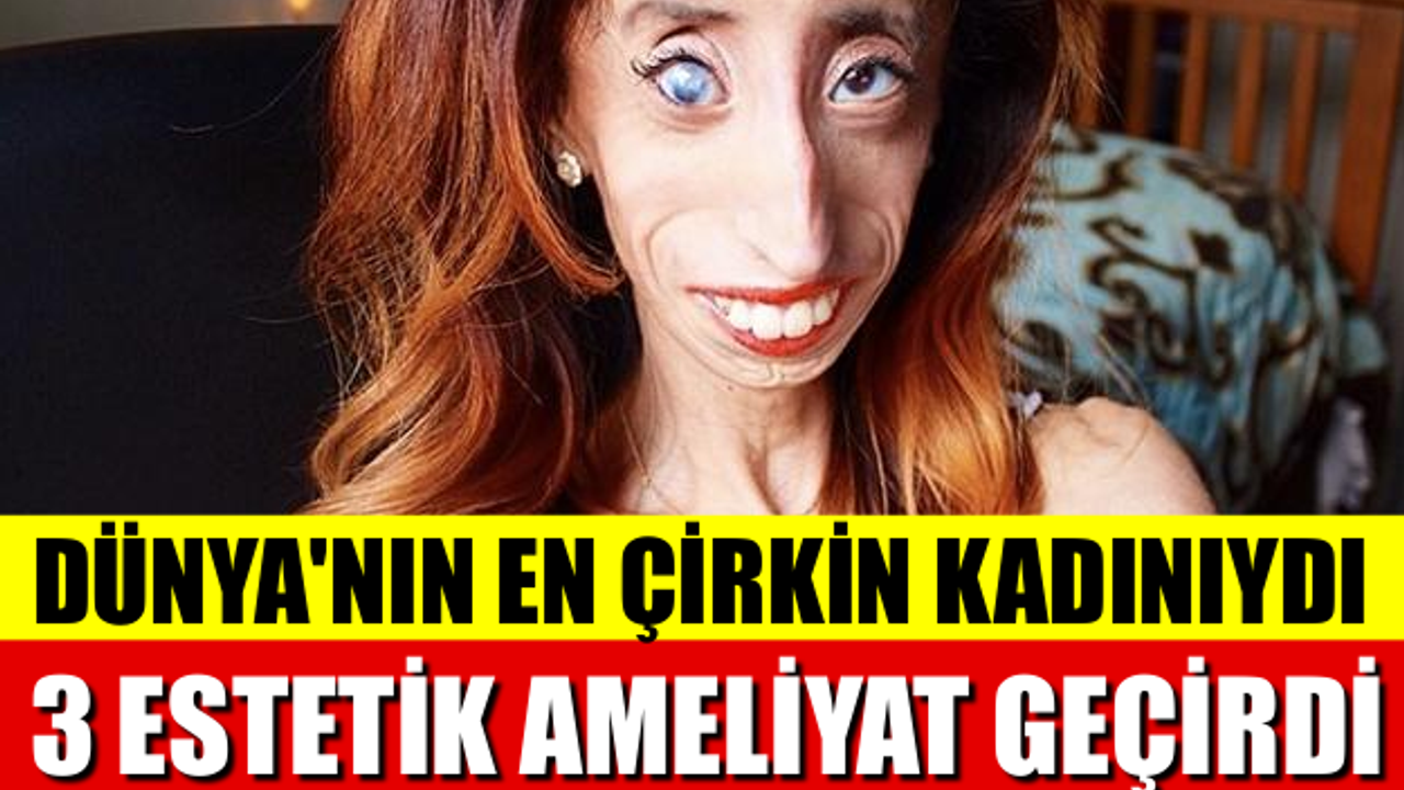 ‘Dünyanın en çirkin kadını’ ilan edilen ‘dünyanın en cesur kadını’yla tanışın.