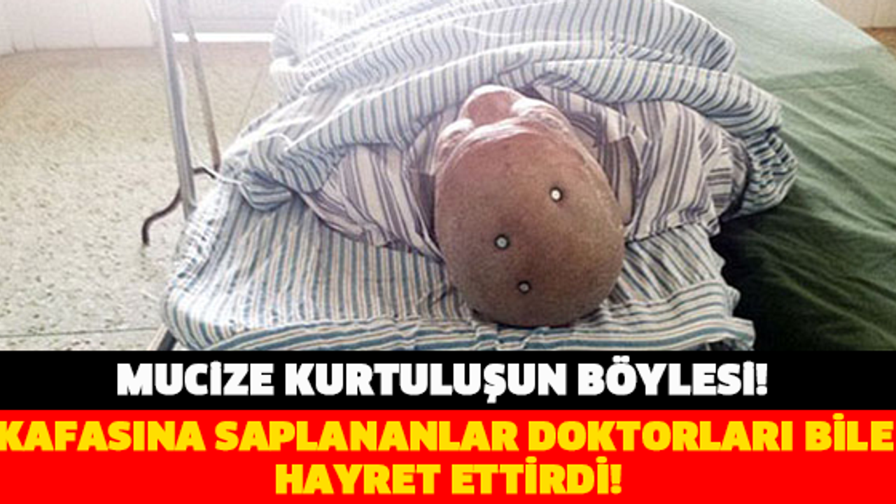 KAFASINA SAPLANANLAR DOKTORLARI BİLE HAYRET ETTİRDİ!