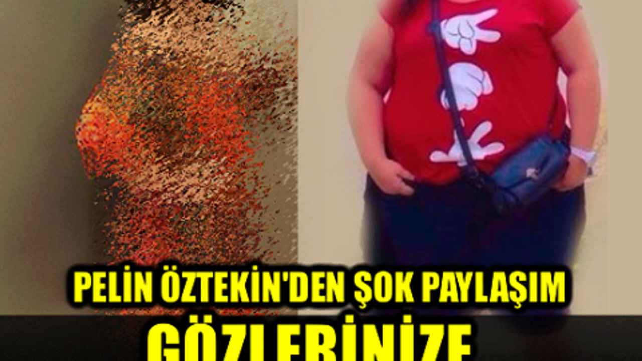 Yok Artık!!! Olmaz Denen Oldu.