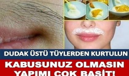 Dudak üstü tüylerden kurtulmak!