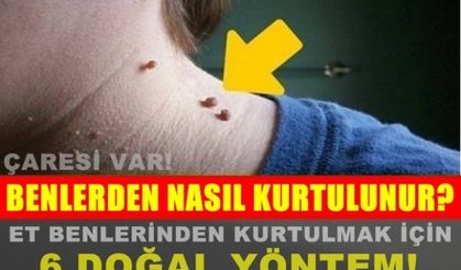 Et Benlerinden Kurtulmak İçin 6 Doğal Yöntem!!