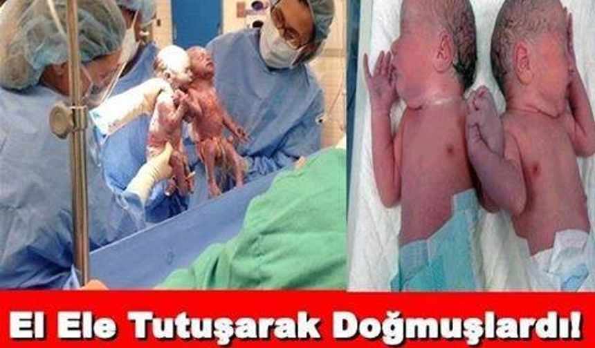 El Ele Tutuşarak Doğmuşlardı! Bakın Şimdi Ne Haldeler!
GALERİ'NİN DEVAMI İÇİN TIKLAYIN..!