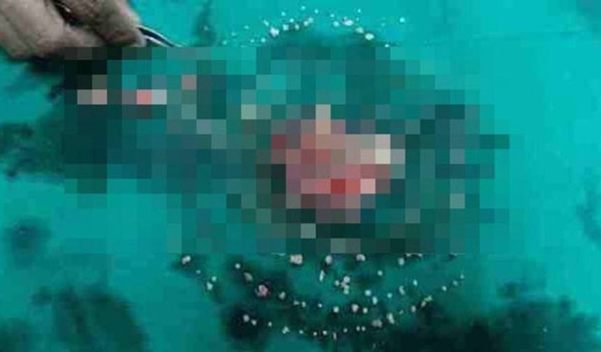 Bu genç adamın dişleri diş hekimlerini şaşkına çevirdi... Eğer birisi size ağzında 232 tane diş olduğunu söyleseydi inanır mıydınız?