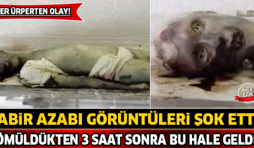Gömüldükten 3 Saat Sonra Bu Hale Geldi ! Kabir Azabımı Görüntüleri Şoke Etti...

HABERİN DEVAMI İÇİN TIKLAYIN...