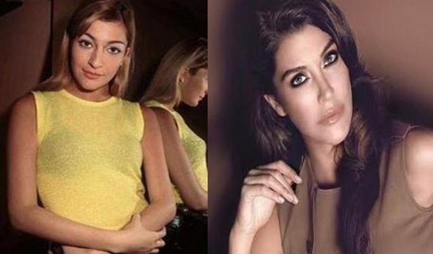 Ünlülerin Estetikten Önceki Ve Sonraki Hallerini Gösteren 14 Çarpıcı Fotoğraf