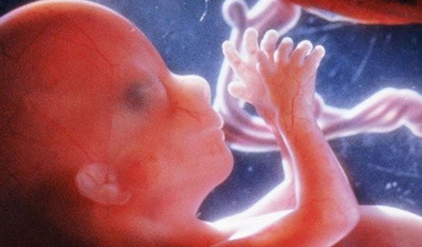 Dünyada görülme ihtimali 5 milyon doğumdan 1&#039;den az olan ve tarihte yalnıza 200 örneği bulunan &quot;fetüs içinde fetüs&quot; (FIF) vakası dünyayı şoke etti.