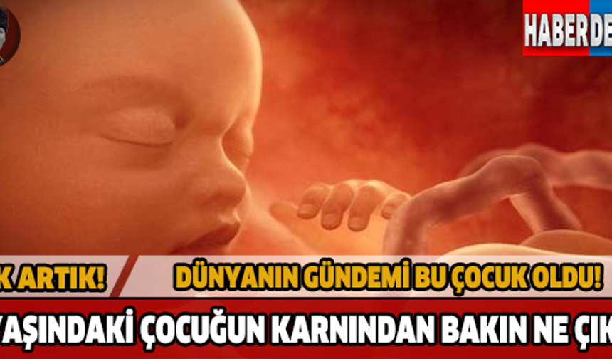 Dünyayı şaşkına çeviren haberin adresi Hindistan. Dört yaşındaki küçük çocuk şiddetli karın ağrısı şikayetiyle hastaneye götürüldü.