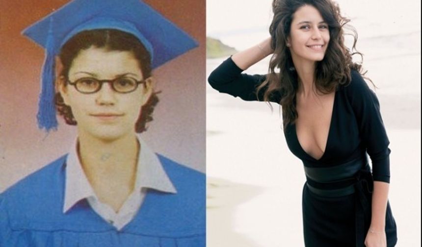 Ünlülerin Estetikten Önceki Ve Sonraki Hallerini Gösteren 14 Çarpıcı Fotoğraf