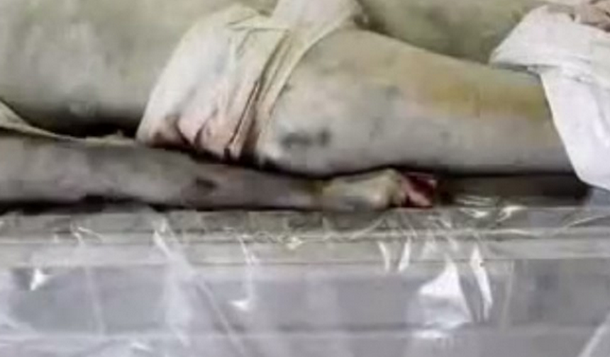 Görgü tanıklarının, akrabalarının ve doktorların ifadelerine göre genç siyah saçlı, hiç bir yerinde kırık, dövülme veya işkence izi olmadan defnedildiğini ifadelerine ediyorlardı.