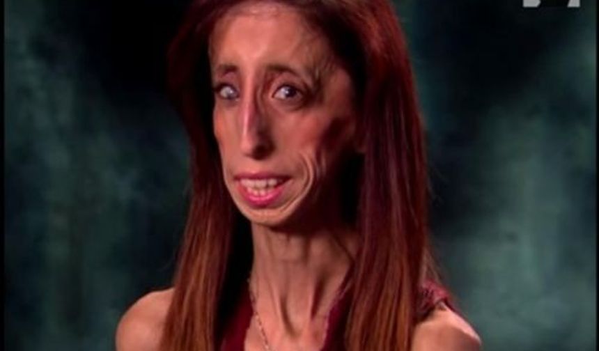 Nadir görülen rahatsızlıklardan birine sahip olan Lizzie Velasquez’in ‘Dünyanın en çirkin kadını‘ seçilmesinden sonra ‘Dünyanın en cesur kadını‘na dönüşme hikayesini anlatan belgesel, galasını yapıyor.