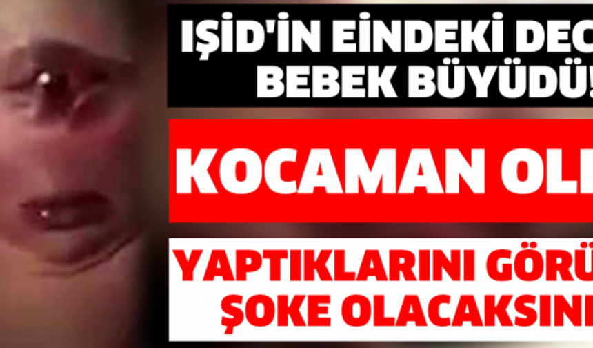 Şimdi Herkes Onu Konuşuyor! Dünyanın Konuştuğu Deccal Bebek Büyüdü!