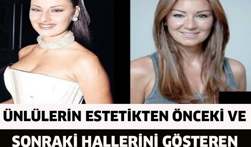 Ünlülerin Estetikten Önceki Ve Sonraki Hallerini Gösteren 14 Çarpıcı Fotoğraf

GALERİYE DEVAM ET....