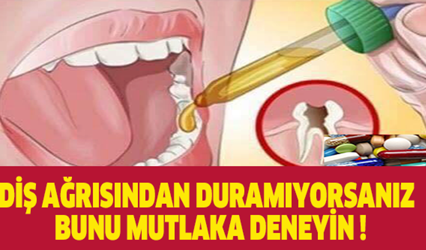 DİŞ AĞRISI ÇEKTİYSENİZ VE ÇEKMEYE DEVAM EDİYORSANIZ MUHAKAK BUNLARI YAPIN!