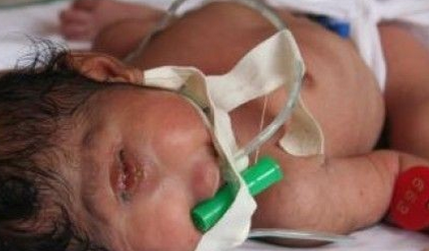 Deccal bebeğin yeni fotoğrafları ortaya çıktı.
