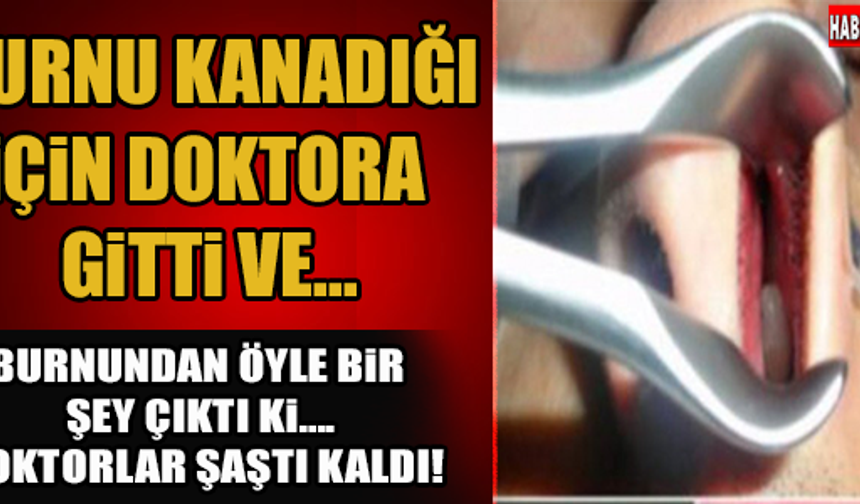 Burnu Kanadığı İçin Doktora Gitti Fakat Sebebini Öğrenince Şoke Oldu!

HABERİN DEVAMI İÇİN TIKLAYIN...