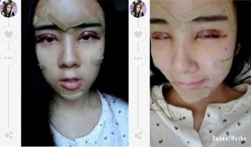 O henüz daha 15 yaşında… Eski erkek arkadaşını geri kazanmak için bir dizi estetik ameliyat geçiren Çinli Lee Hee Danae, sonunda doğal güzelliğini tamamen kaybetti. Lee artık bir Çinli gibi değil, daha çok ‘porselen bebek’ gibi görünüyor. İşte onun ilginç hikâyesi…