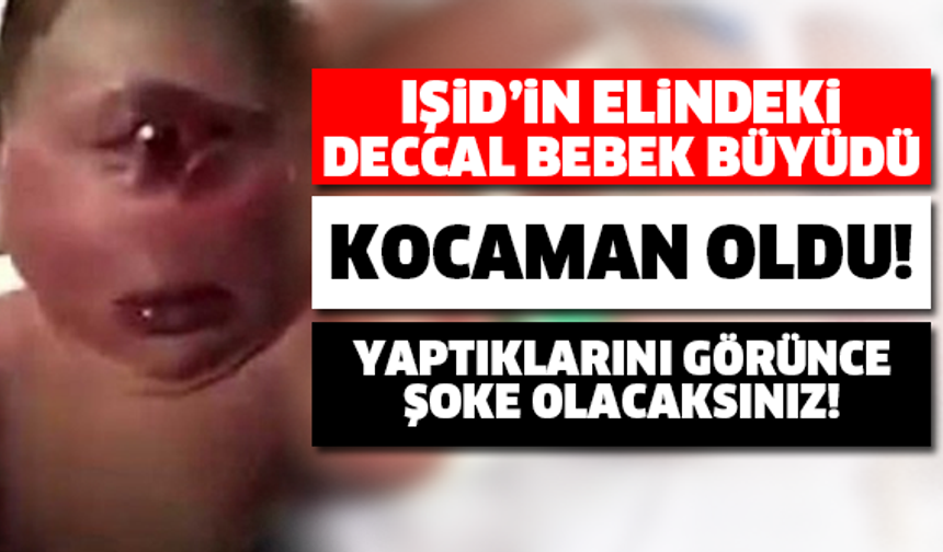 Şimdi Herkes Onu Konuşuyor! Dünyanın Konuştuğu Deccal Bebek Büyüdü!
