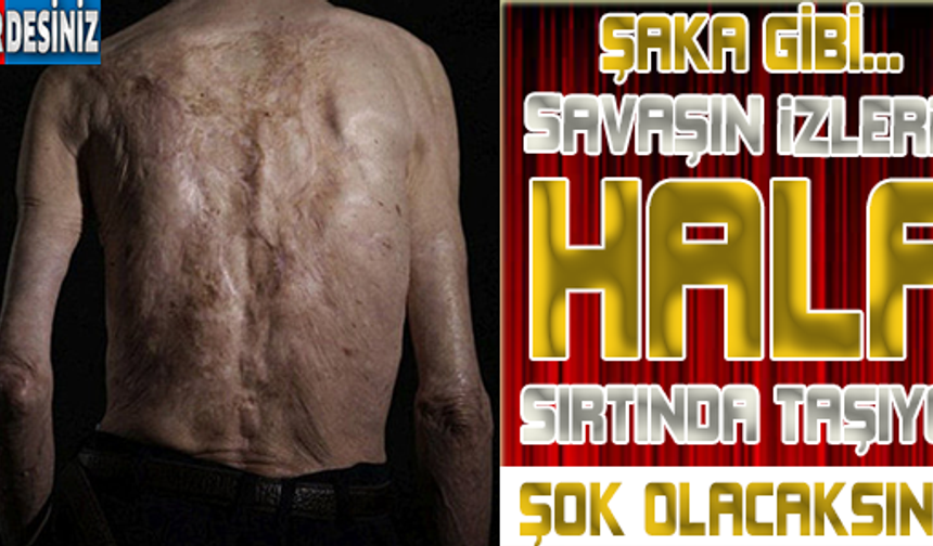 HÂLÂ SAVAŞIN İZLERİNİ TAŞIYOR!

HABERİN DEVAMI İÇİN TIKLAYIN...