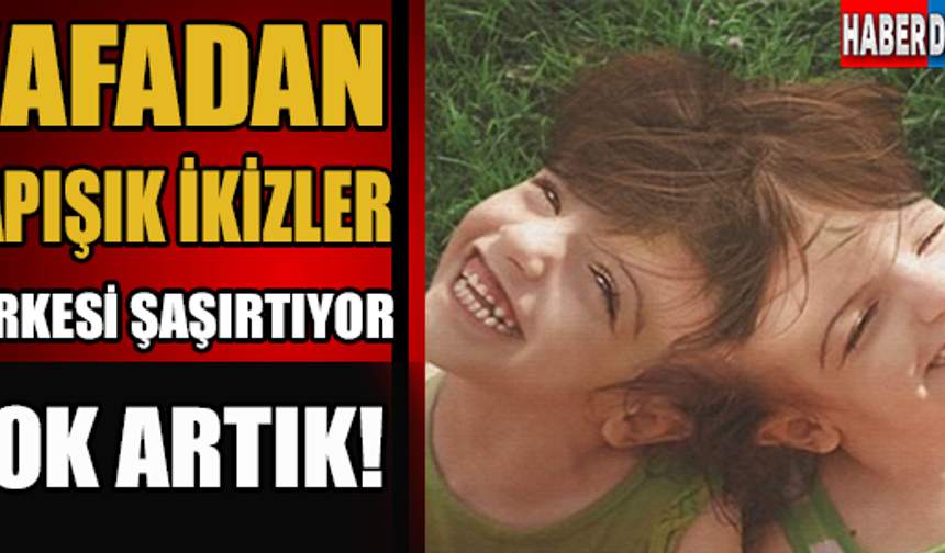 Kafadan yapışık ikizler herkesi şaşırtıyor !

GALERİNİN DEVAMI İÇİN TIKLAYIN...
