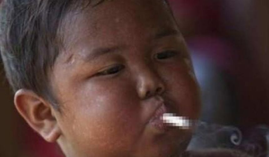 Aldi Rizal şimdi 5 yaşında, sigarayı bırakmayı başardı ancak şimdi başı yeni bir belayla dertte: Obezli