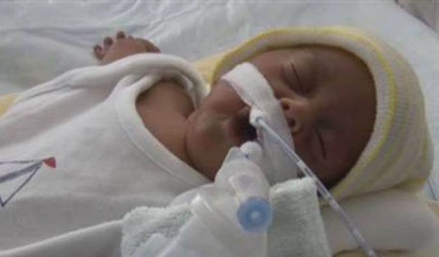 Samsun Liman Hastanesi’nde Ayşen ve Bülent Çebi çiftinin 4 kilo 420 gram ağırlığında ve