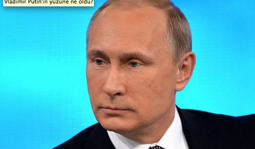 Rusya Devlet Başkanı Vladimir Putin&#039;in yüzü ile ilgili dedikoduların ardı bitmek bilmiyor. Kimisi zehirlendi ondan yüzü bu hale geldi derken kimileri de estetik ameliyattan dolayı bu hale geldiğini iddia etti. Yıllardan beridir Putin&#039;in estetik ameliyatı olduğu söylentileri devam ediyor.