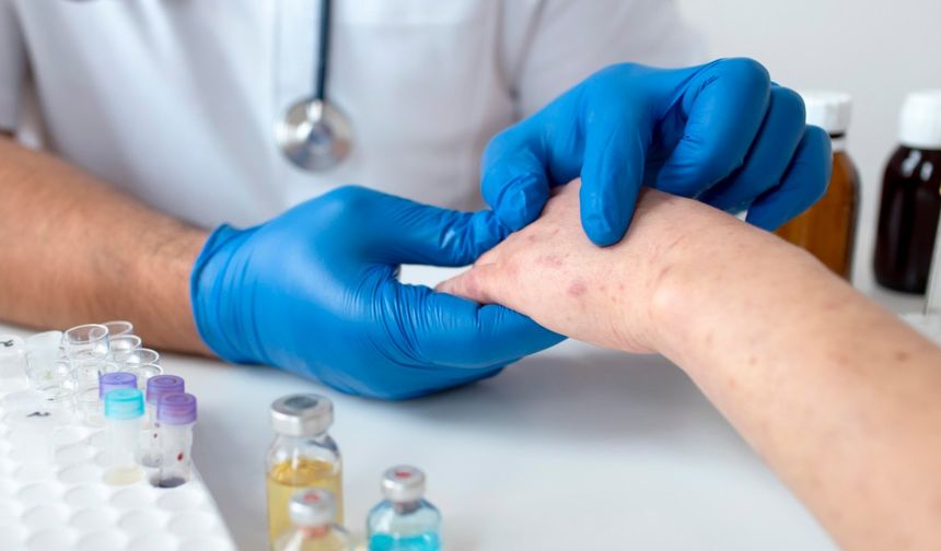 Vücudunuzdaki Virüs Her An Uyanabilir!