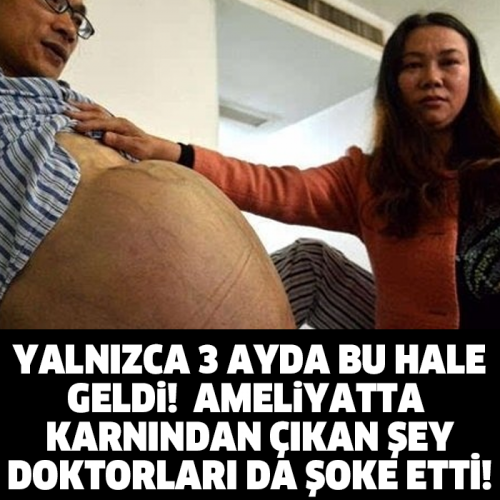 YALNIZCA 3 AYDA BU HALE GELDİ! AMELİYATTA KARNINDAN ÇIKAN ŞEY DOKTORLARI DA ŞOKE ETTİ!